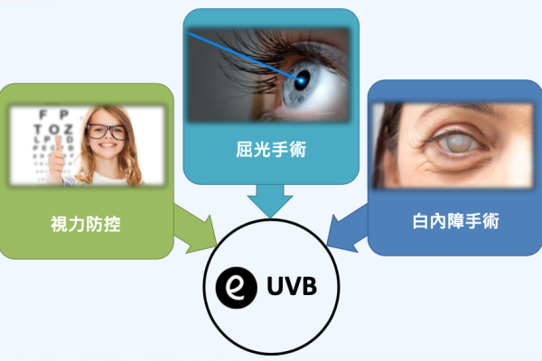 大學光三大業務主軸：視力防控、屈光手術、白內障手術 大學光屈光、白內障手術增，台灣 4 新門市激勵成長 2022 Sep